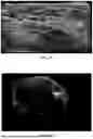 Fig. 08 - Methods, Processes, and Systems for Soft and Glandular Tissue Vascularity Assessment