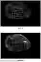 Fig. 09 - Methods, Processes, and Systems for Soft and Glandular Tissue Vascularity Assessment