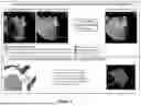 Fig. 02 - SYSTEMS AND METHODS FOR MACHINE LEARNING BASED ULTRASOUND ANATOMY FEATURE EXTRACTION