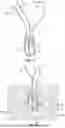 Fig. 07 - KNOTLESS TENSIONABLE FIXATION SYSTEMS AND SURGICAL METHODS FOR REPAIRING TISSUE DEFECTS