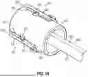 Fig. 13 - ENDOSCOPE CLEANING SHEATH WITH INTEGRAL POSITION SENSOR