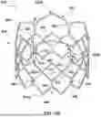Fig. 35 - DEVICES AND METHODS FOR MULTI-ALIGNMENT OF IMPLANTABLE MEDICAL DEVICES
