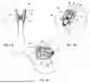 Fig. 07 - EXPANDABLE INTERBODY FUSIONS DEVICES