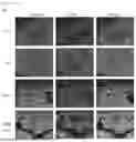 Fig. 13 - ENTERITIS-SUPPRESSING COMPOSITION