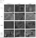 Fig. 14 - ENTERITIS-SUPPRESSING COMPOSITION