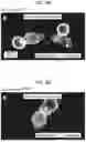 Fig. 06 - Methods of Treating Lymphoma with a Phagocyte Having a Chimeric Antigen Receptor