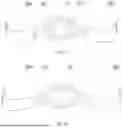 Fig. 20 - EXHAUST ASSEMBLY, FRAME ASSEMBLY, CUSHION ASSEMBLY AND PATIENT INTERFACE DEVICE