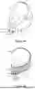 Fig. 17 - HEADGEAR FOR A RESPIRATORY INTERFACE