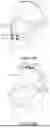 Fig. 19 - HEADGEAR FOR A RESPIRATORY INTERFACE