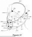 Fig. 23 - HEADGEAR FOR A RESPIRATORY INTERFACE