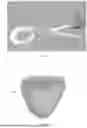 Fig. 02 - MOUNTING DEVICE OF CARDIAC NET AND METHOD OF MOUNTING CARDIAC NET
