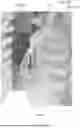 Fig. 12 - MOUNTING DEVICE OF CARDIAC NET AND METHOD OF MOUNTING CARDIAC NET