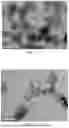 Fig. 02 - CATALYTIC CRACKING CATALYST COMPRISING A LARGE-PARTICLE-SIZE SOL AND APPLICATION THEREOF