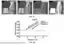 Fig. 07 - SYSTEMS AND METHODS FOR CULTURING PODOCYTES AND USES THEREOF