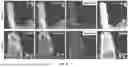 Fig. 22 - SYSTEMS AND METHODS FOR CULTURING PODOCYTES AND USES THEREOF