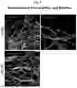 Fig. 07 - PROTOCOL GENERATING TISSUE SPECIFIC ENDOTHELIAL CELL LINE, NAMED LIOVECS (LUNG TISSUE IPSC ORIGIN VESSEL ORGANOID ENDOTHELIAL CELL) AND BIOVECS (BLOOD VESSEL STEM CELL IPSC ORIGIN VESSEL ORGANOID ENDOTHELIAL CELLS)