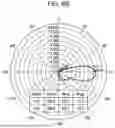 Fig. 11 - ANTENNA DEVICE