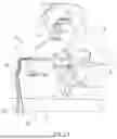 Fig. 02 - SURGICAL STERILE FIELD