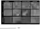 Fig. 09 - METHOD FOR EXPANSION AND MAINTENANCE OF NK CELLS FOR IMMUNOTHERAPY