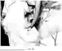 Fig. 15 - Wearable Auricular Neurostimulator and Methods of Use