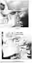 Fig. 17 - Wearable Auricular Neurostimulator and Methods of Use