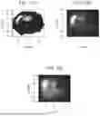 Fig. 24 - Collimatorless Combined Compton and Proximity Imaging Technology