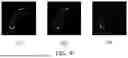 Fig. 10 - METHOD AND SYSTEM FOR COMPUTING BLOOD FLOW VELOCITY BASED ON MEDICAL IMAGE