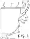 Fig. 09 - TISSUE SPECIMEN RETRIEVAL BAG, METHOD FOR RETRIEVING TISSUE