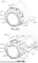 Fig. 40 - KIDNEY STONE TREATMENT SYSTEM