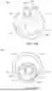 Fig. 43 - KIDNEY STONE TREATMENT SYSTEM