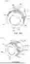Fig. 46 - KIDNEY STONE TREATMENT SYSTEM