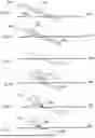 Fig. 09 - Methods and Apparatuses for Attaching Hair Using Surgical Thread