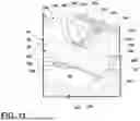 Fig. 10 - PATIENT SUPPORT SYSTEM WITH TRANSFERABLE SUPPORT SURFACE