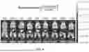 Fig. 07 - EXTRACELLULAR VESICLES FROM MICROALGAE, THEIR BIODISTRIBUTION UPON ADMINISTRATION, AND USES
