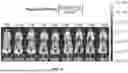 Fig. 09 - EXTRACELLULAR VESICLES FROM MICROALGAE, THEIR BIODISTRIBUTION UPON ADMINISTRATION, AND USES