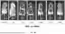 Fig. 72 - EXTRACELLULAR VESICLES FROM MICROALGAE, THEIR BIODISTRIBUTION UPON ADMINISTRATION, AND USES