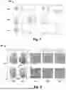 Fig. 09 - METHOD AND APPARATUS USING COMPUTATIONAL PATHOLOGY FOR RISK STRATIFICATION OF CANCER