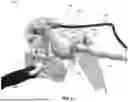 Fig. 35 - ADJUSTABLE POSITION LIMB SUPPORT FOR SURGICAL TABLES, INCLUDING LOCKING GAS CYLINDER