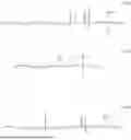 Fig. 74 - RESIST COMPOSITION, RESIST PATTERN FORMATION METHOD, COMPOUND, ACID-GENERATING AGENT, ACID DIFFUSION CONTROL AGENT, AND HIGH-MOLECULAR-WEIGHT COMPOUND