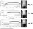 Fig. 07 - BLOOD VOLUME SENSOR SYSTEM