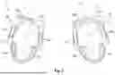 Fig. 03 - VERTICALLY DIVIDED FEEDER FOR USE IN METAL CASTING IN CASTING MOLDS AND METHOD FOR PRODUCTION THEREOF