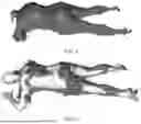 Fig. 09 - AUTOMATIC MASSAGE METHOD