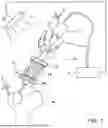 Fig. 02 - DEVICE FOR IMPROVING THE ACCURACY OF MANUAL OPERATIONS