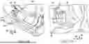 Fig. 11 - Systems for a drive unit