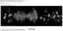 Fig. 06 - SYSTEMS AND METHODS FOR EVENT-DRIVEN ULTRASOUND SAMPLING