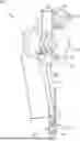 Fig. 01 - MEDICAL DEVICE ACTUATORS