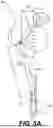 Fig. 06 - MEDICAL DEVICE ACTUATORS