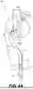 Fig. 08 - MEDICAL DEVICE ACTUATORS