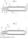 Fig. 02 - Implant Delivery System