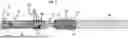 Fig. 07 - Implant Delivery System